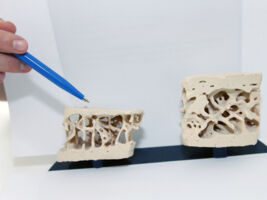 LKHB_FLS_poroeser vs gesunder Knochen.jpg