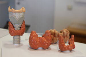 Schilddrüse_Modell; (c)VLKH.JPG