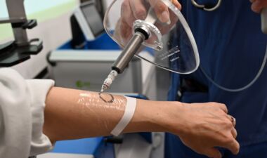 Symbolbild 1_Radioaktive Paste bei weißem Hautkrebs (c)VLKH