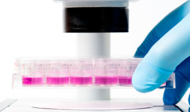 iStock_000002010786Small_genetische untersuchung