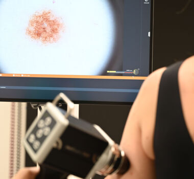 KI hilft beim Erkennen von schwarzem Hautkrebs (c)VLKH